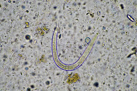 microorganismos de compost bajo un microscopio que incluye ameba, flagelados, nematodos, hongos, bacterias