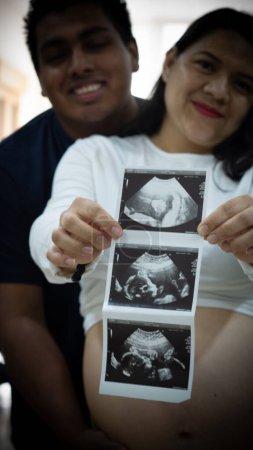 Foto de Mujer embarazada sosteniendo ecografía - Imagen libre de derechos