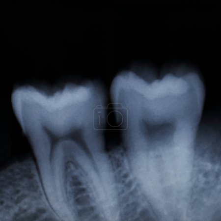 Es ist Zähne Röntgen für Muster und Design.