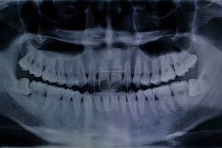 it is teeth x-ray for pattern and design.