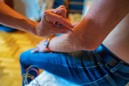 Téléchargez les photos : Close-up of shirtless man receiving dry needling therapy from physician in clinic Close-up of physiotherapist performing dry needling treatment on leg. Injury recovery procedure - en image libre de droit