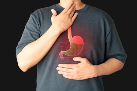 Reflux gastro-?sophagien (RGO) ou symptômes de reflux acide. Homme souffrant de brûlures d'estomac, maux d'estomac, nausées et ballonnements. Maladies du système gastro-intestinal et problèmes digestifs.
