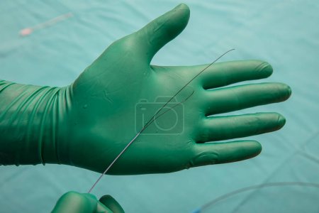 Photo for Coronary Imaging Catheter. Dual Lumen Catheter. Coronary angiography showing Micro Catheter guidewire. - Royalty Free Image
