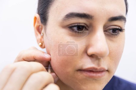 Photo for Dry needle treatment. A portrait of a small acupuncture needle sticking in a person's face next to the nose, to heal pain, relieve stress or another medical condition with alternative medicine. - Royalty Free Image
