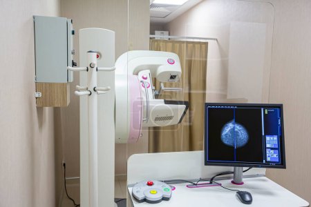 Téléchargez les photos : Test de mammographie à l'hôpital. Matériel médical. Appareil de mammographie de dépistage mammaire en laboratoire hospitalier. Soins de santé, technologie médicale, concept d'équipement de haute technologie. - en image libre de droit