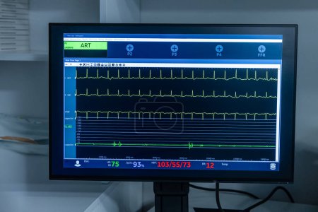 Modern equipment with vital signs monitors in operating room of contemporary clinic. Cardiogram signal monitoring process. The patient's vital signs are displayed on the screen. ECG, ECG curves.