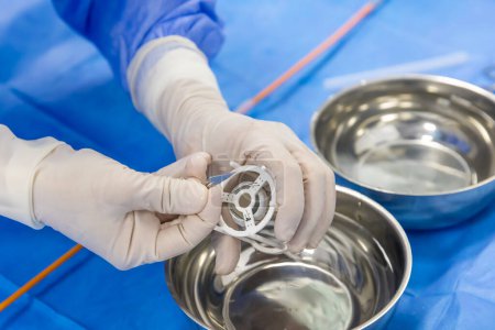 Cardiología de cirugía valvular para paciente hospitalizado. Preparar implante de válvula aórtica transcatéter en la mano del médico.