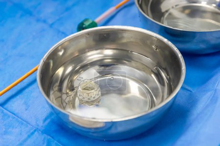 Cardiología de cirugía valvular para paciente hospitalizado. Preparar implante de válvula aórtica transcatéter en la mano del médico.
