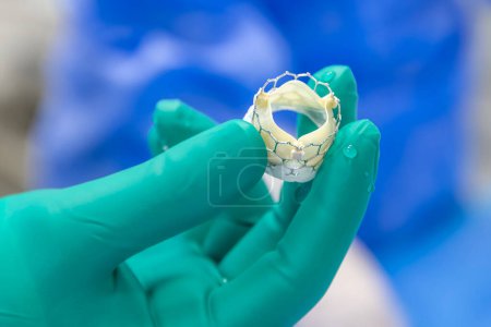 Photo for Heart valve surgery cardiology for patient in hospital. Prepare Transcatheter aortic valve implantation in doctor's hand. - Royalty Free Image