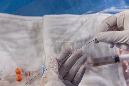 Photo for Interventional cardiology. Surgeon doctor at operation. Stent and catheter for implantation into blood vessels with an empty and filled balloon. - Royalty Free Image