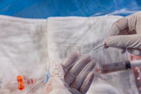 Interventional cardiology. Surgeon doctor at operation. Stent and catheter for implantation into blood vessels with an empty and filled balloon. 