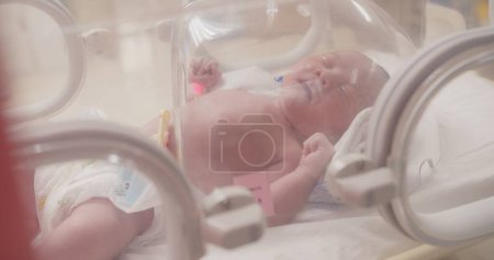 Primer plano pequeño bebé recién nacido en incubadoras para recién nacidos, recién nacido que tiene el problema respiratorio después del nacimiento, recién nacido en la UCIN, unidad de cuidados intensivos neonatales, atención médica