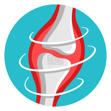 Illustration for Healthy Joints - anti rheumatoid arthritis therapy and medication. Flat vector colorful icon - Royalty Free Image