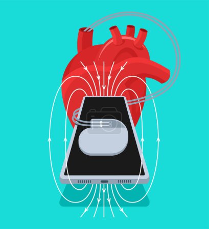 Ilustración de Los imanes dentro de los teléfonos celulares modernos pueden potencialmente desactivar los marcapasos u otros dispositivos médicos implantables - Imagen libre de derechos
