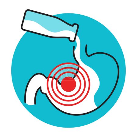 Ilustración de Enfermedad por intolerancia a la lactosa - silueta estomacal con frasco de leche que causa círculos de dolor. Icono de vector aislado - Imagen libre de derechos