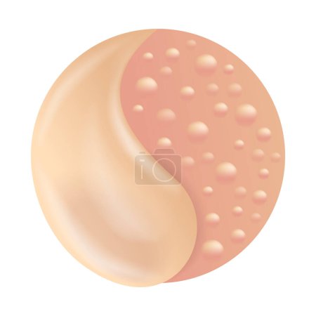 Hautpilzbehandlung Symbol für Medikamente, die Ketoconazol oder andere Verbindungen enthalten. Kreisförmiges Emblem im 3D Stil