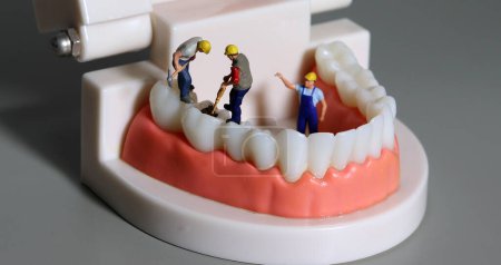 Miniature people on models of teeth. People taking care of teeth.