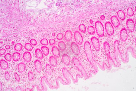 Photo for Backgrounds of Characteristics Tissue of Stomach Human, Small intestine Human, Pancreas Human and Large intestine Human under the microscope in Lab. - Royalty Free Image