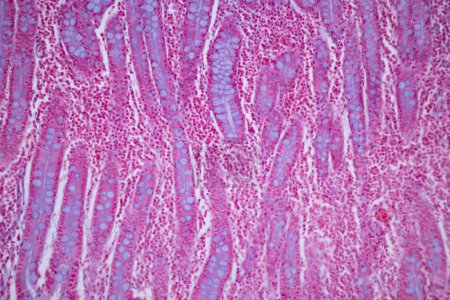 Foto de Tissue of Small intestine (Duodenum), Large intestine Human and Stomach Human under the microscope in Lab. - Imagen libre de derechos
