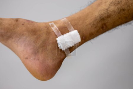 Photo for Close up injured at leg and hand, Fresh wounds from accident. - Royalty Free Image