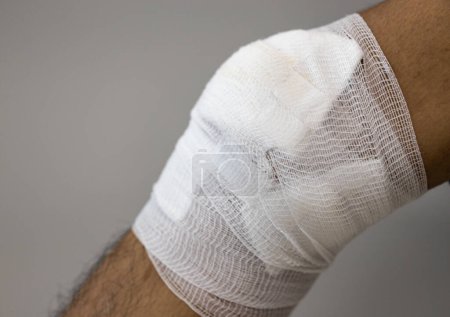 Photo for Close up injured at leg and hand, Fresh wounds from accident. - Royalty Free Image