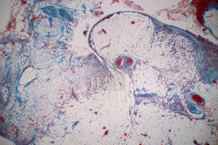 Foto de Mostrando micrografo de luz Tipo de tejido humano bajo el microscopio en el laboratorio. - Imagen libre de derechos