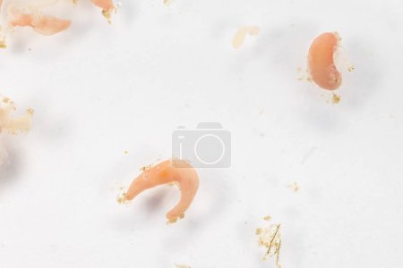 Photo for Study of Parasitic helminths (Trematodes) of marine fishes under a microscope. - Royalty Free Image