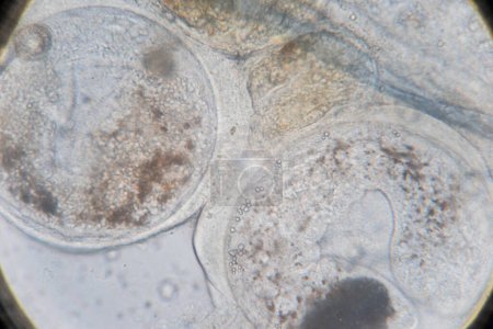 Téléchargez les photos : Étude des helminthes parasites (Trematodes) des poissons marins au microscope. - en image libre de droit