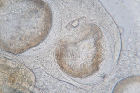 Foto de Estudio de helmintos parásitos (Trematodes) de peces marinos bajo un microscopio. - Imagen libre de derechos
