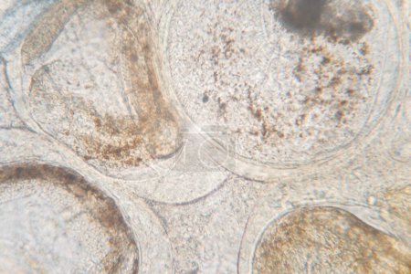 Téléchargez les photos : Étude des helminthes parasites (Trematodes) des poissons marins au microscope. - en image libre de droit
