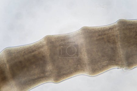 Téléchargez les photos : Ténias (Cestoda : Caryophyllidea), parasites des poissons en Thaïlande. - en image libre de droit