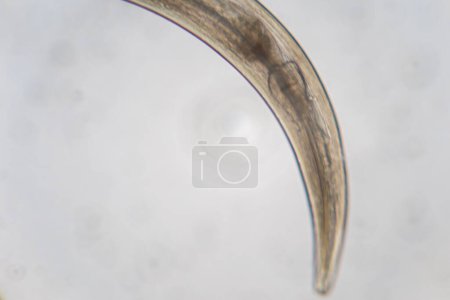 Foto de Estudio de helmintos parásitos (Trematodes) y Ascaris de peces bajo un microscopio. - Imagen libre de derechos