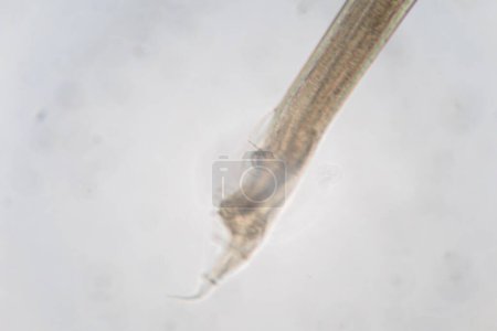 Photo for Study of Parasitic helminths (Trematodes) and Ascaris of fishes under a microscope. - Royalty Free Image