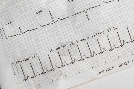 Photo for Cardiogram, waves of heart beat, EKG on the paper, arrhythmia - Royalty Free Image