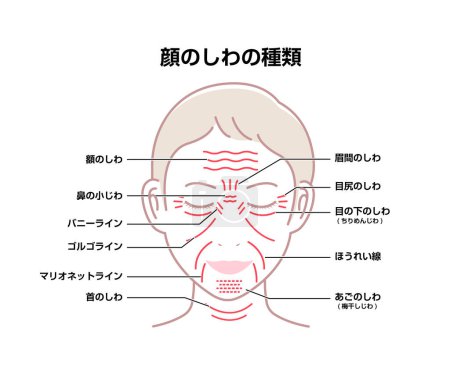 Illustration for Facial wrinkles ( female face ) vector illustration / Japanese - Royalty Free Image