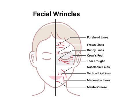 Ilustración de vectores de arrugas faciales (cara femenina)
