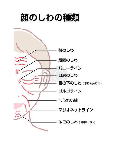 Illustration for Facial wrinkles ( female face ) vector illustration / Japanese - Royalty Free Image
