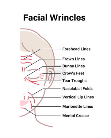 Illustration for Facial wrinkles ( female face ) vector illustration - Royalty Free Image
