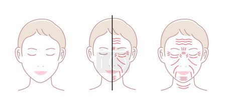 Illustration for Facial wrinkles ( female face ) vector illustration set / no text - Royalty Free Image