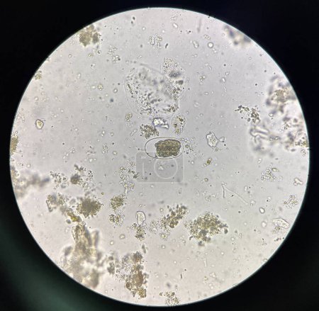Foto de Hookworm egg human parasite in stool examination test find microscope 40x. - Imagen libre de derechos