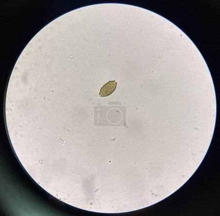 Foto de Trichuris trichiura egg  egg human parasite in stool examination test find microscope 40x. - Imagen libre de derechos