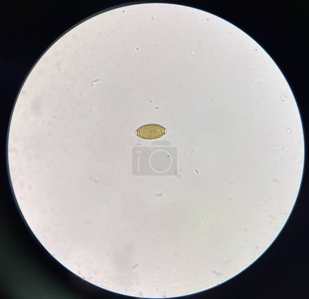 Foto de Trichuris trichiura egg  egg human parasite in stool examination test find microscope 40x. - Imagen libre de derechos