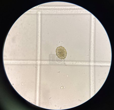 Foto de Ascaris lumbricoides  egg human parasite in stool examination test find microscope 40x. - Imagen libre de derechos