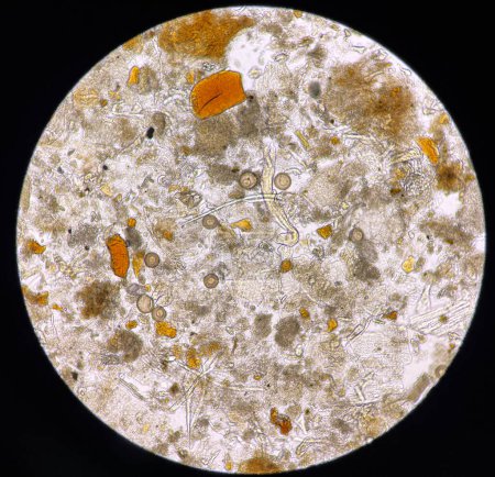 Foto de Hymenolepis diminuta egg human parasite in stool examination test find microscope 40x. - Imagen libre de derechos