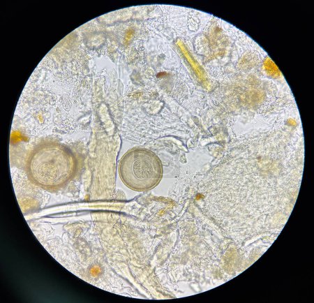 Foto de Hymenolepis diminuta egg human parasite in stool examination test find microscope 40x. - Imagen libre de derechos