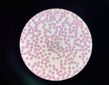 Photo for Normalchromic normocytic red blood cell Wright stain. - Royalty Free Image