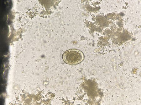 Foto de Ascaris lumbricoides  egg human parasite in stool examination. - Imagen libre de derechos