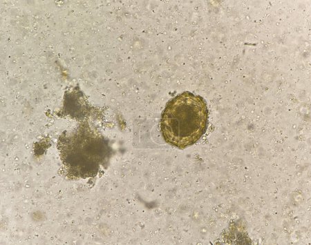 Foto de Ascaris lumbricoides  egg human parasite in stool examination. - Imagen libre de derechos