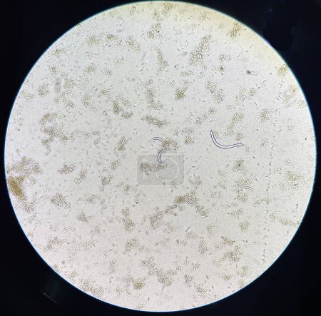 Téléchargez les photos : Strongyloides stercolari larve se déplaçant dans les selles fraîches en laboratoire. - en image libre de droit