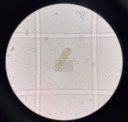 Téléchargez les photos : Planche Moulée dans de l'urine fraîche découverte au microscope. - en image libre de droit